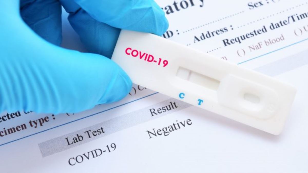 Testele de coronavirus, acum la îndemâna oricui